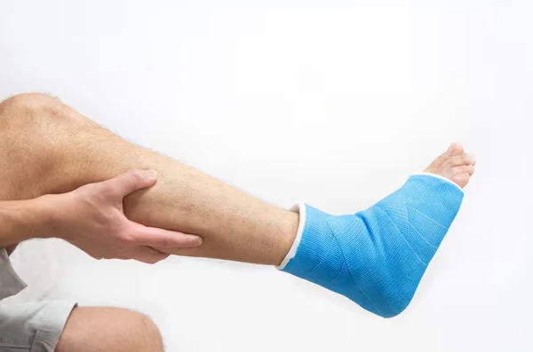 Bone Fracture Treatment Including Plaster Application