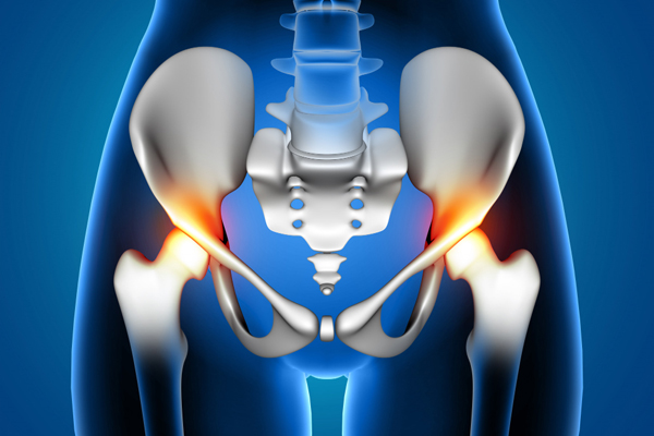 Direct Anterior Aproach Hip replacement